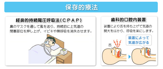 睡眠時無呼吸症候群（SAS）の治療